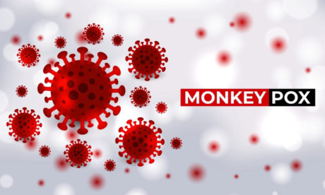 Monkeypox Awareness: Symptoms, Diagnosis, and Treatment